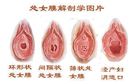 女人下面的真实模样 女人下面的真实模样