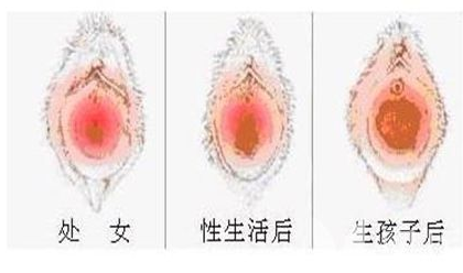 女人下面的真实模样 女人下面的真实模样